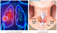 新闻资讯-高晶板_负离子生态硅晶板_医院集成吊顶_嵌入式隔帘轨道_医用隔帘_湖北星立方科技有限公司【官网】